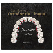Insights em Ortodontia Lingual
