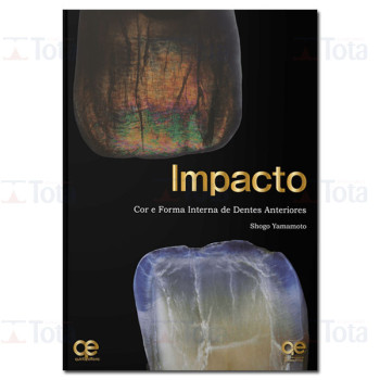 IMPACTO: Cor e Forma Interna de Dentes Anteriores