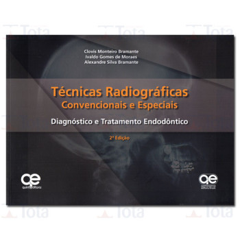 Técnicas Radiográficas Convencionais e Especiais - Diagnostico e Tratamento Endodôntico