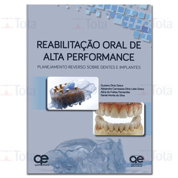 Reabilitação Oral de Alta Performance: Planejamento Reverso sobre Dentes e Implantes