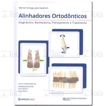 Alinhadores Ortodônticos - Diagnóstico, Biomecânica, Planejamento e Tratamento 