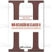 Má Oclusão de Classe II 