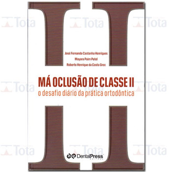 Má Oclusão de Classe II 