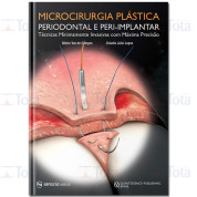 Microcirurgia Plástica Periodontal e Peri-Implantar