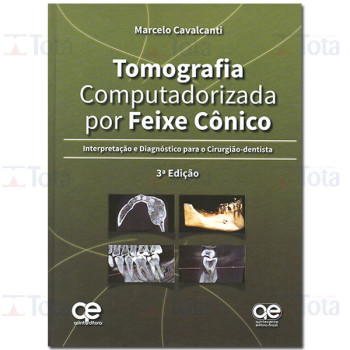 Tomografia Computadorizada por Feixe Cônico