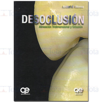 Desoclusión • Alineación Tridimensional y Oclusión