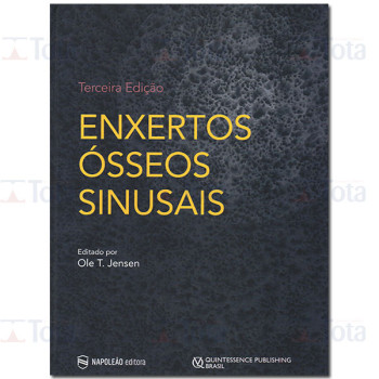 Enxertos Ósseos Sinusais