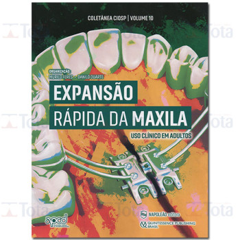 Expansão Rápida da Maxila - CIOSP VOL 10 