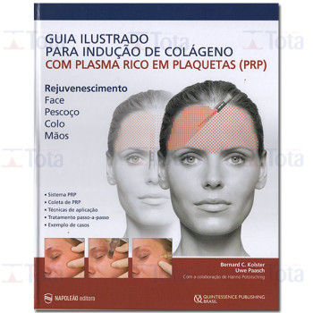 Guia Ilustrado para indução de Colágeno com Plasma Rico em Plaquetas (PRP)