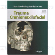 Trauma Craniomaxilofacial 