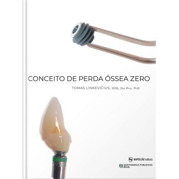 Conceito De Perda Óssea Zero 