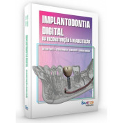 Implantodontia Digital - Da Reconstrução à Reabilitação 