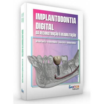 Implantodontia Digital - Da Reconstrução à Reabilitação 