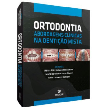 Ortodontia: Abordagens Clínicas na Dentição Mista