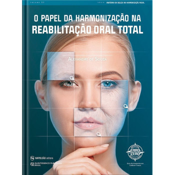 O Papel Da Harmonização Na Reabilitação Oral Total