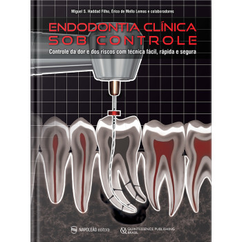 Endodontia Clínica Sob Controle – Controle Da Dor E Dos Riscos Com Técnica Fácil, Rápida E Segura