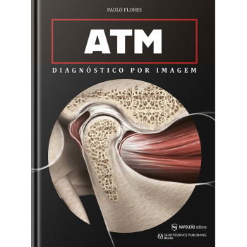 ATM – Diagnóstico Por Imagem