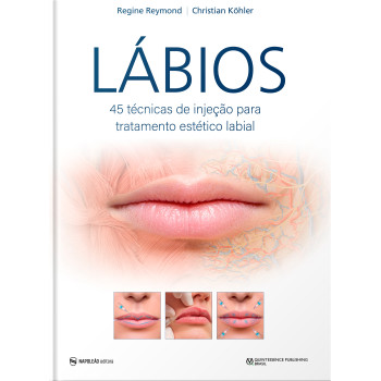 Lábios – 45 Técnicas De Injeção Para Tratamento Estético Labial