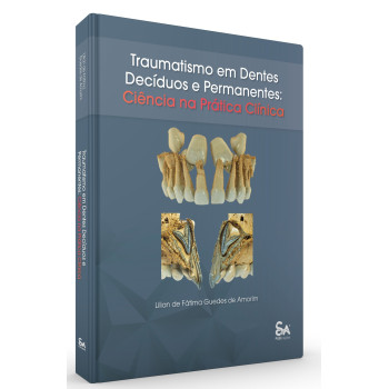 Traumatismo em Dentes Decíduos e Permanentes: Ciência na Prática Clínica