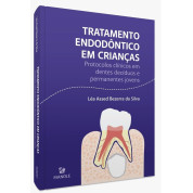 Tratamento Endodôntico em Crianças - Protocolos Clínicos em Dentes Decíduos e Permanentes Jovens 