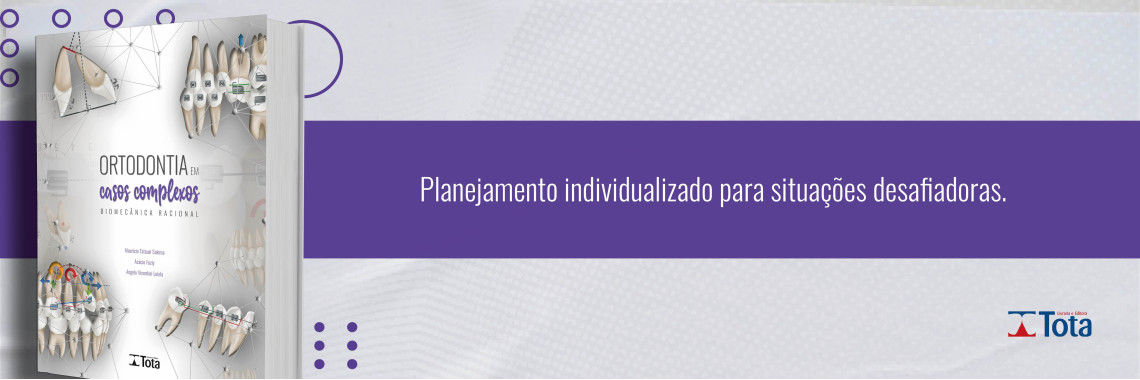 Ortodontia Em Casos Complexos - Biomecânica Racional