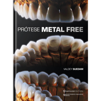 Prótese Metal Free