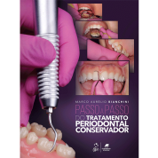 Passo A Passo Do Tratamento Periodontal Conservador