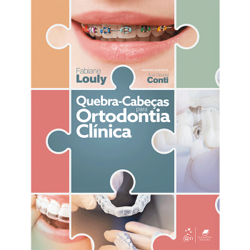 Quebra - Cabeças Para Ortodontia Clínica