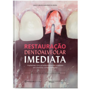 Restauração Dentoalveolar Imediata - Implantes Com Provisionalização Imediata Em Alvéolos Comprometidos 